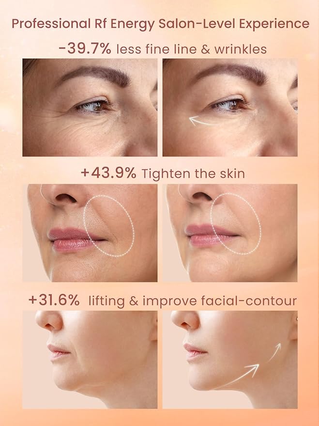 Radio Frequency Skin Tightening Device, Professional Wireless Home RF Face Machine for Anti-Aging, Wrinkle Reduction, Lifting, Firming with 3 Levels