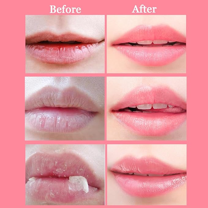 2 Pcs Bee Lip Balm Honey Wrinkle