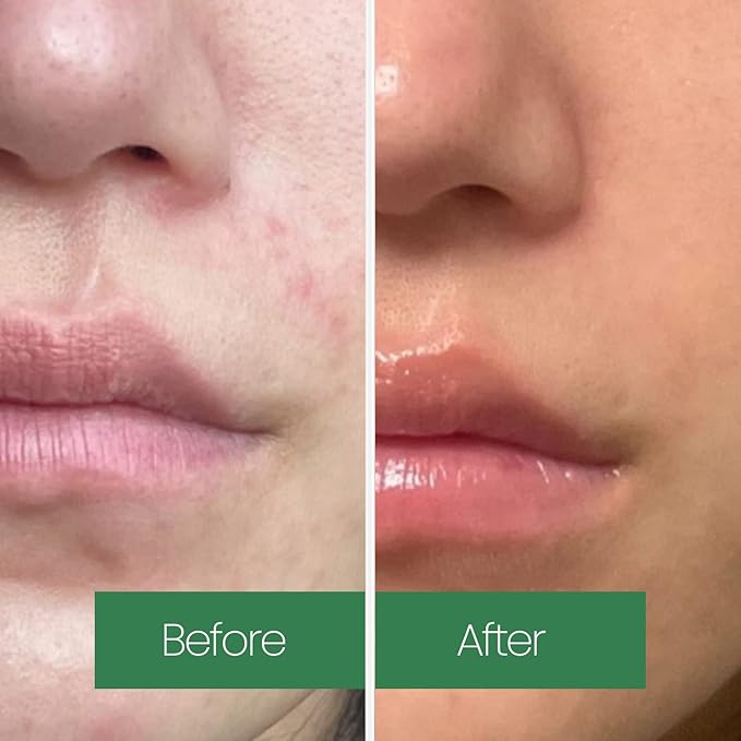 LAPALETTE Calming Green Turnover Toner | Green Tea | Hydrating & Moisturizing | Gentle Peeling with Natural Aha, Bha & PHA Ingredients | Korean Skincare 6.75fl.oz