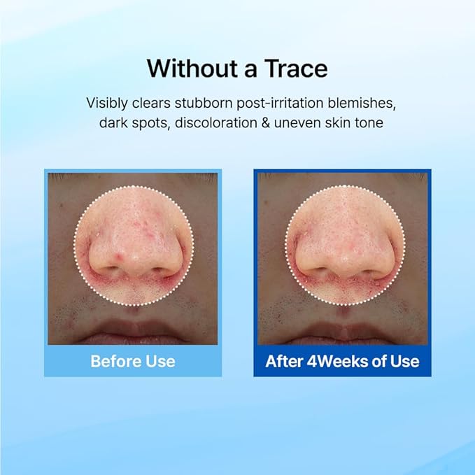 DearKlairs Midnight Blue Clearing Water Gel Cream 1.76 Ounce, Improve Dullness, Pigmentation, Red Spot, Bumps, No irritation, For Oily Skin