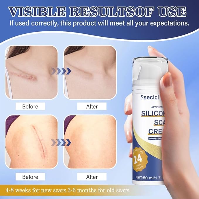 Scar Cream,Silicone Scar Gel,Advanced Scar Gel,Scar 1.7 oz