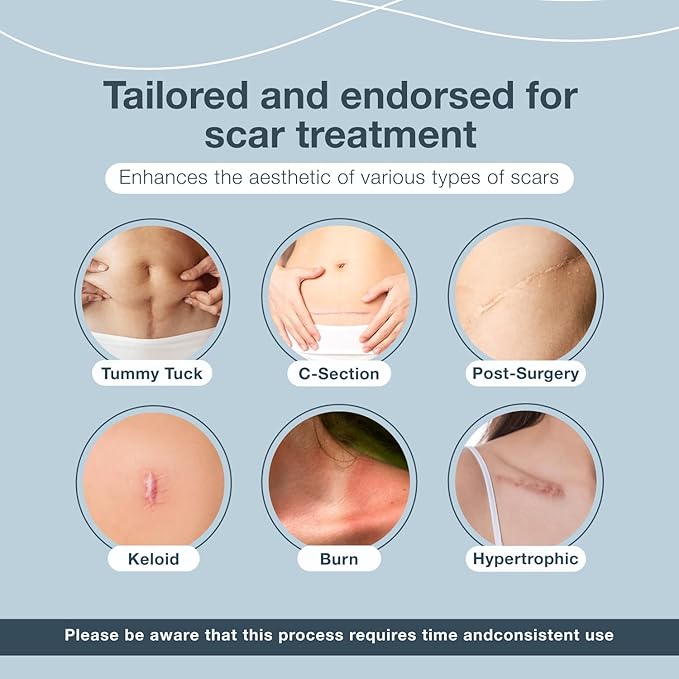 Silicone Scar Sheets Tape, Strips