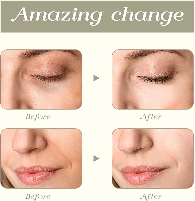 Tekson Faical Roller Massager, 3D Metal Face Massage Tool for Reduce Puffiness, Remove Eye Wrinkles, Face Lift, Increase Firmness, Anti-Aging, Skin Tightening