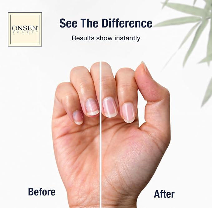 Onsen Cuticle Cream w/Nail Cuticle