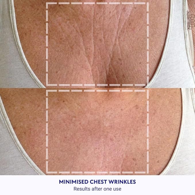 Wrinkles Schminkles Chest Wrinkle Patch & Cleanser Starter Pack - Set of Reusable Chest Silicone Wrinkle Patch + Patch Cleanser (2 oz) Maximise Uses - Smooth & Prevent Chest & Décolletage Wrinkles
