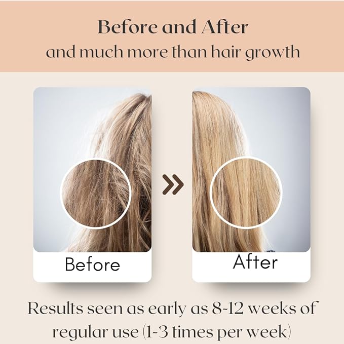 REVATOLOGY Hair Growth Oil for Adults (Made in USA) pre-rinse Formula with 30 Oils and Herbal extracts Reduces Hair Fall, Boosts Regrowth & Strengthens Roots | Cruelty & Chemical Free