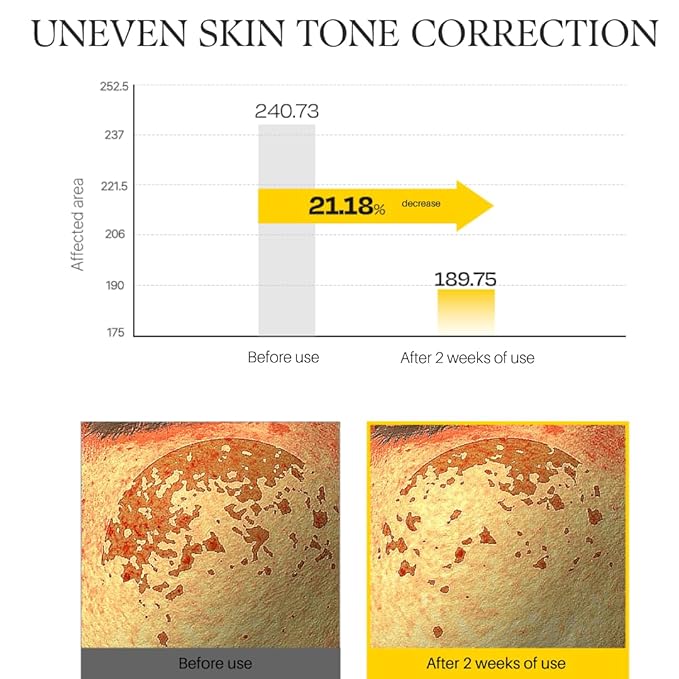 d'alba Piedmont Vita Toning Capsule Serum, Daily Vita Boost for Luminous Skin, Double Vitamin Formula, Big Size (3.38fl. oz.)