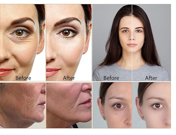 Glutathione Serum with 5+Peptides -20,000ppm Glutathione brightening 50X dark spot Serum for Face- Hyperpigmentation Serum, Anitoxidants B3,B5 C E Niacinamide fights Aging Signs [5 serum in 1]