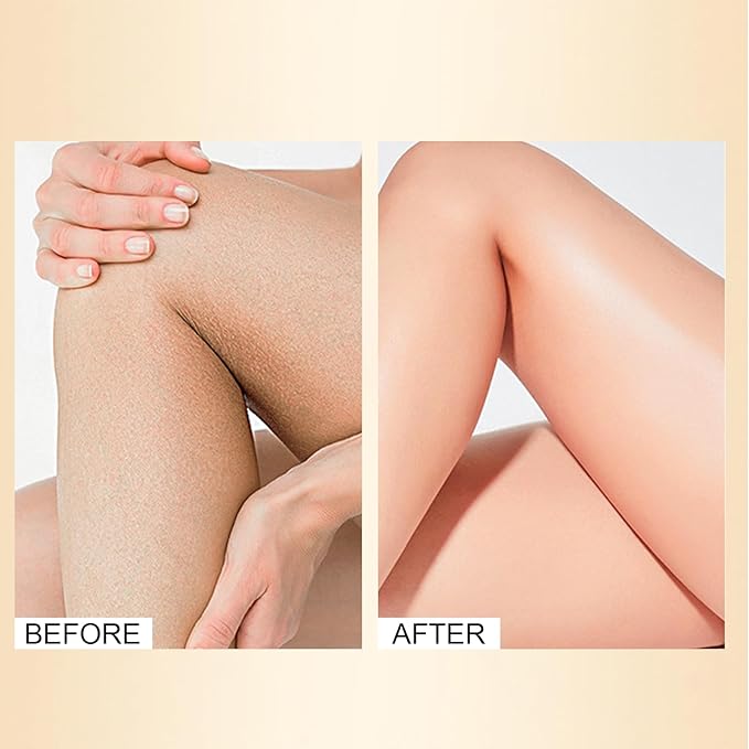 Leg Makeup Waterproof No Transfer, Leg Vein Cover up Makeup, Long-Lasting Body Concealer Makeup Lotion, Coverage for Vein, Scar, Tattoo for All Skin Tones (Bronze)