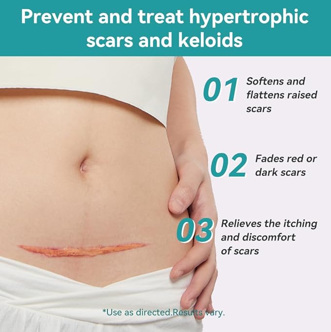 Dimora Professional Silicone Scar Sheets -