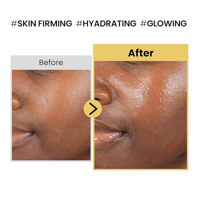 coxir INTENSIVE EGF PEPTIDE CREAM l Day&Night Firming Cream l EGF(Epidermal Growth Factor), Peptides, Niacinamide, Panthenol, Collagen l Korean Skincare [50ml/1.69fl.oz]