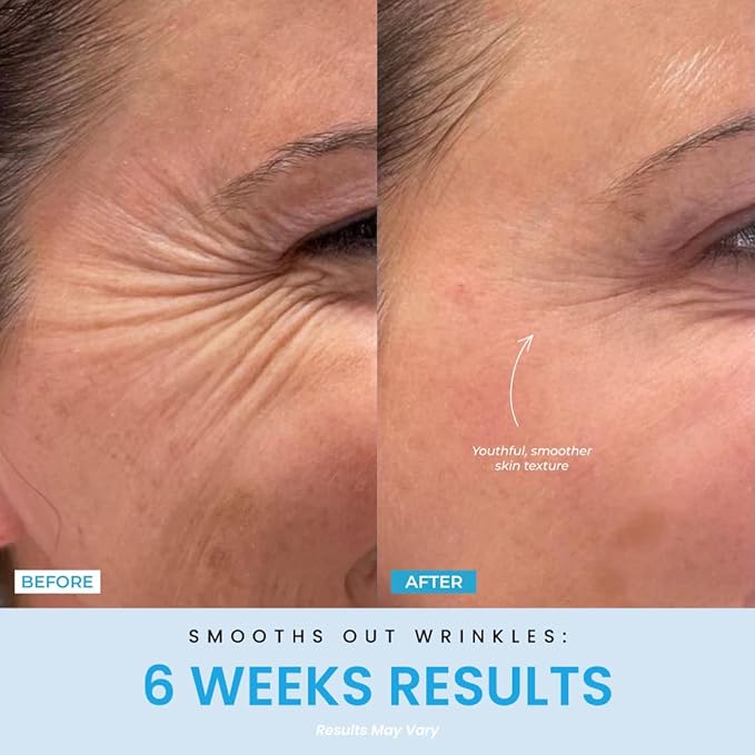 Red Light Therapy Face & Neck Massager – LiftLab 3-in-1 LED Sculptor with Blue & Green Modes – Jawline & Double Chin Tightening, Wrinkle & Spot Care -Improved Battery