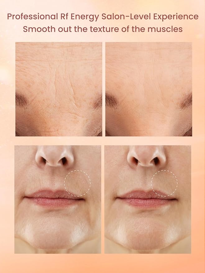 Radio Frequency Skin Tightening Device, Anti-Aging Face Machine for Wrinkle Removal, Lifting & Firming, Wireless Home Beauty Device with 3 Levels, at-Home Skin Renewal