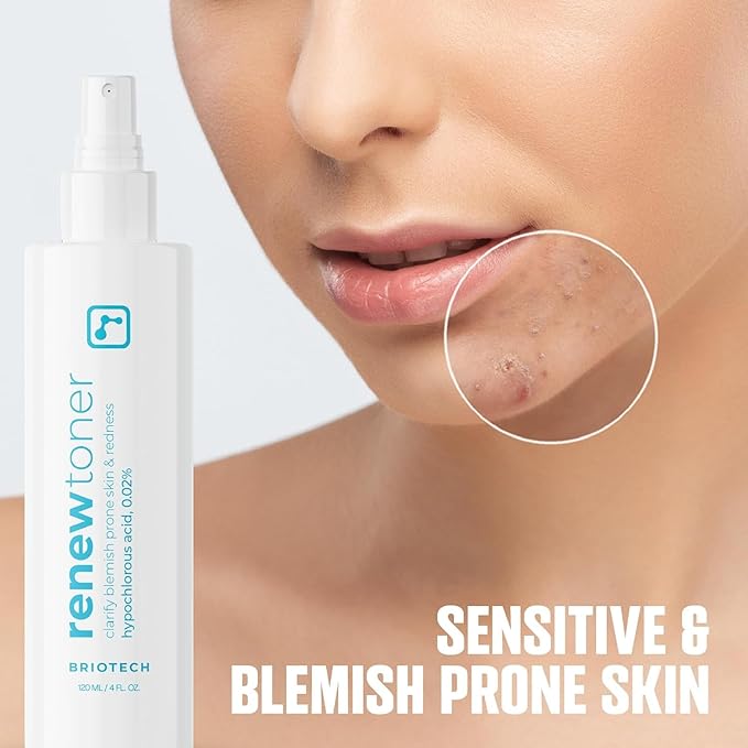 BRIOTECH Renew Toner, Hypochlorous Acid Spray, Minimize Appearance of Blemishes, Soothing Facial Mist for Sensitive Skin, Calm Redness & Bumps, Vegan, 2 fl oz Travel Size