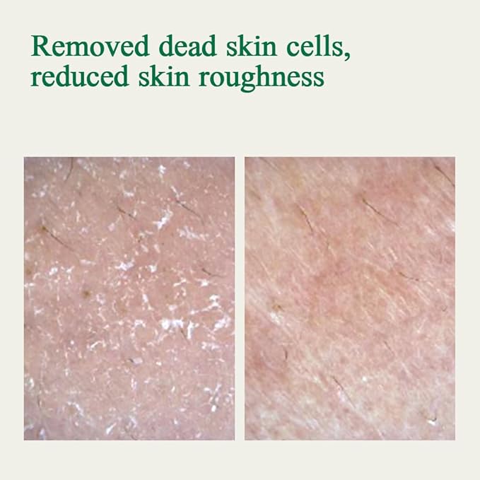 Pyunkang Yul PKY Ultimate Calming Solution Ampoule for Sensitive Skin with Patented Ingredients, Serum Intensely Calms & Soothes Redness with Cica & Tea Tree, Korean Skincare (1.01 Fl. Oz, 30ml)