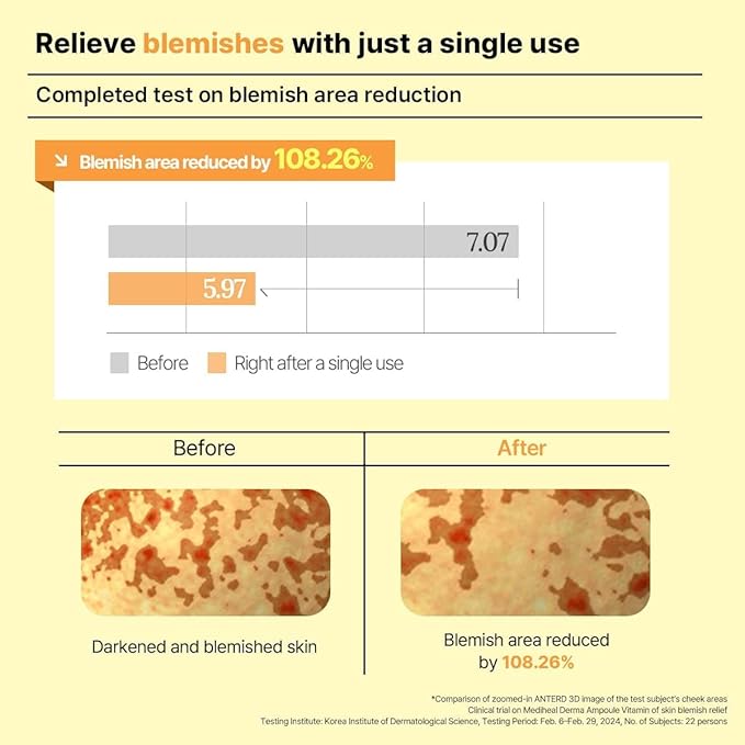 Mediheal Derma Modeling Pack (Vitamin) - Radiance Care For Smooth Skin - Easy DIY Home Spa Kits, Hydrating Icy Jelly Mask For Skin Refreshment