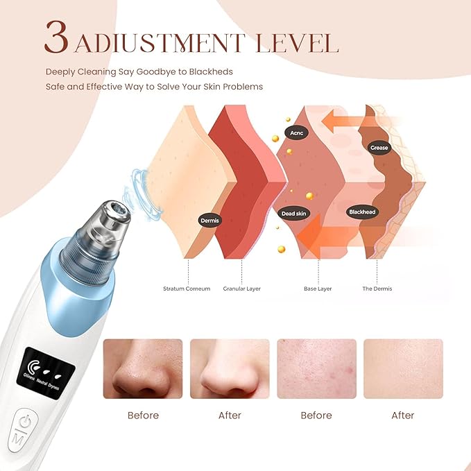2025 Blackhead Remover Pore Vacuum,Facial Pore Cleaner-5 Suction Power,5 Probes,USB Rechargeable Blackhead Vacuum Kit Electric Acne Extractor Tool for Adult
