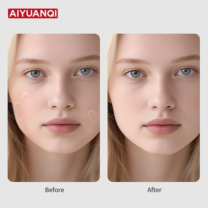 Large Pimple Patches For Face, Invisible Hydrocolloid Acne Patches, Salicylic Acid & Tea Tree, 2 Sizes 180 Counts Spot Stickers for Covering Zits and Blemishes