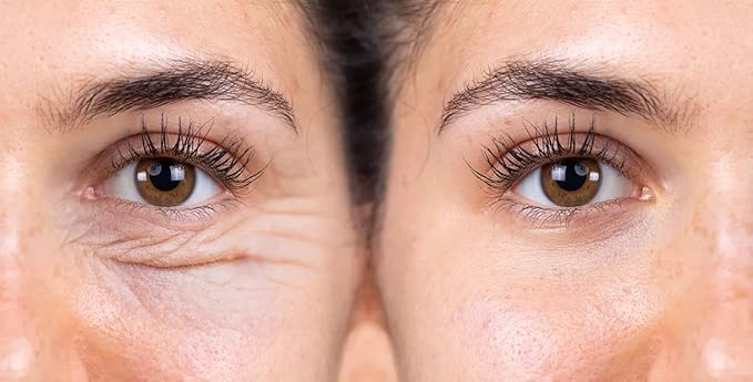 Royal Jelly Eye Beelift