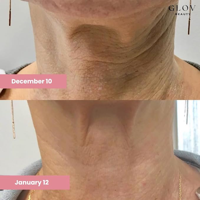 Glov Beauty - Lift & Firm Neck Cream - Anti-Aging Neck & Décolleté Cream for Wrinkles, Sagging Skin & Tightening - With Shea Butter, Niacinamide & Hyaluronic Acid - All Skin Types