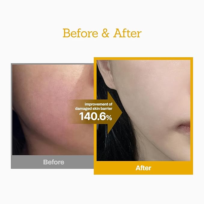 MEDITHERAPY Jojoba Ceramide Barrier Cream, Intensive Repair Cream, Long-Lasting Hydration, Boosts Skin Strength, EWG Green Grade, 3.38 fl.oz.