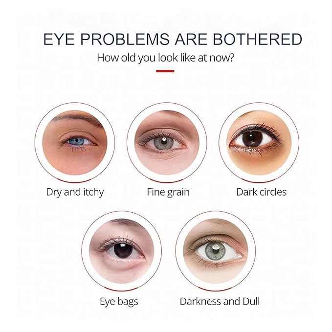 Open eyes awaken peptide lifting eye gel,peptide eye lifting gel,Reduces Dark Circles, Dark circles Hydrating firming Eye cream (3PCS)