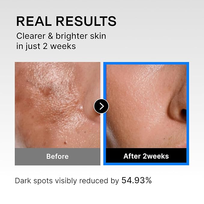 Celladix Crystal Facial Cleansing Soap with Tray – Gentle Morning Cleanser for Oily Skin, 0.00% Irritation, korean skincare 3.17oz (90g) 1ea