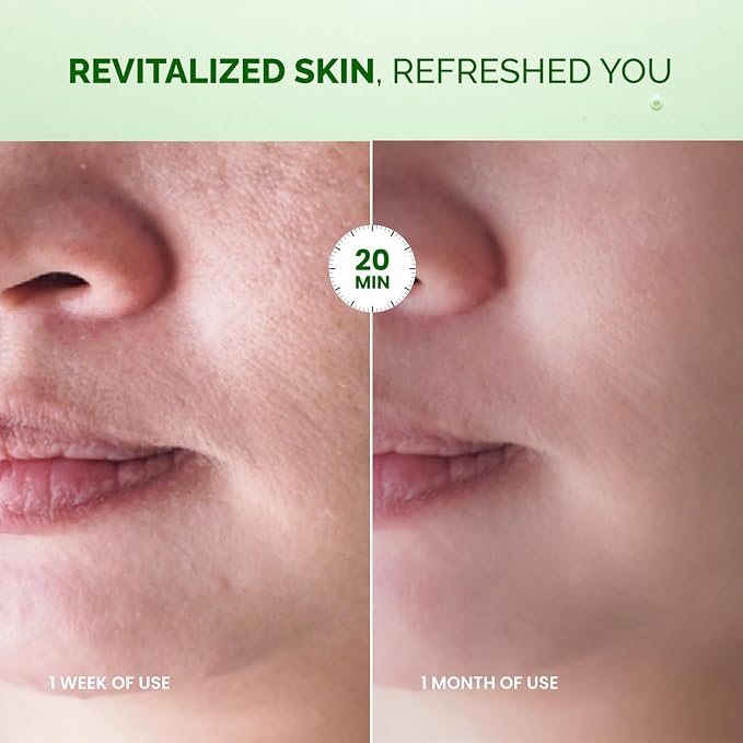 PLANTIFIQUE Superfood Facial Sheet Mask Variety Box 10 Pack – 2x Coconut, Aloe, Vitamin C, Centella & Collagen Face Masks – Hydrating & Glow-Enhancing – For All Skin Types