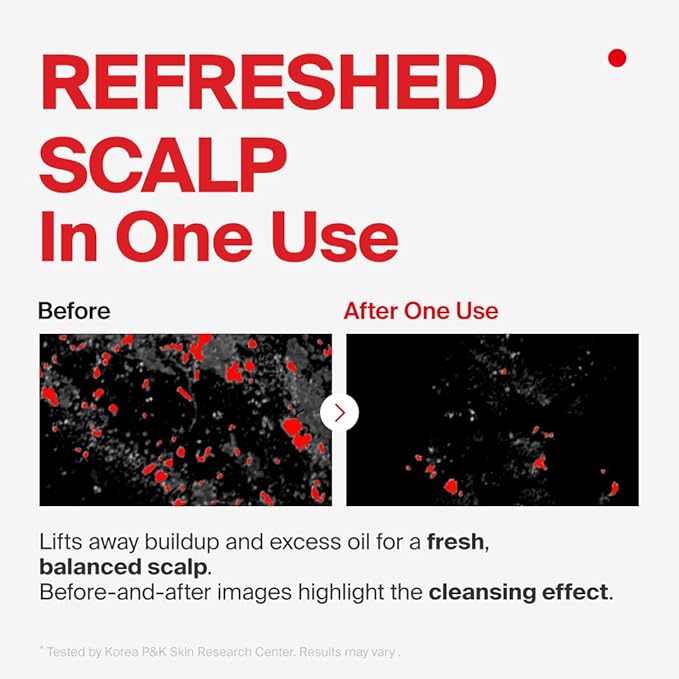 Dr.forhair Folligen Hair Loss Prevention Shampoo, 16.9 Fluid Ounce