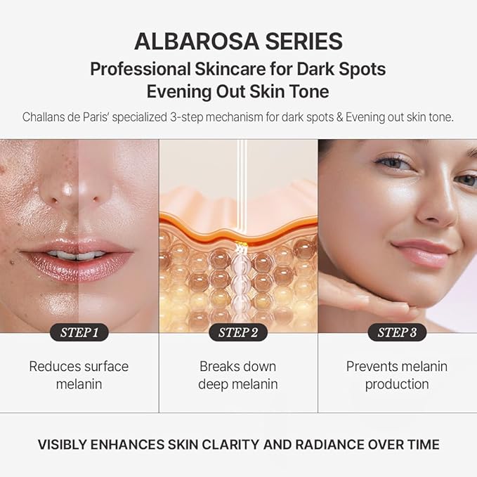 [CHALLANS de PARIS] Ampoule de Albarosa Dark Spot Care Serum – Sun Damage Repair, Brightening & Hydration, Face Ampoule for Even Skin Tone, Lightweight Korean Skincare, 1.23 fl oz