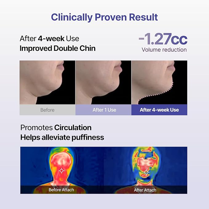 MEDITHERAPY Tension Up Mask 5EA - Korean Collagen Face V Line Lifting Mask - Hydrating Firming & Skin Tightening for Sharp & Sculpted Contour - Matrixyl & Peptide Gel Facial Mask for Youthful Radiance