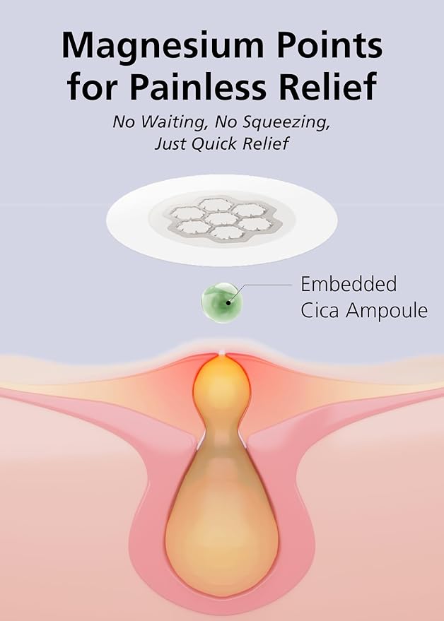 EasyDerm Quick Calming Magnesium Patches – 30 Patches Bulk Pack, Individually Wrapped Acne Care, Includes Tweezers & Ampoule, Korean Skincare, Made by Daewoong Pharmaceutical