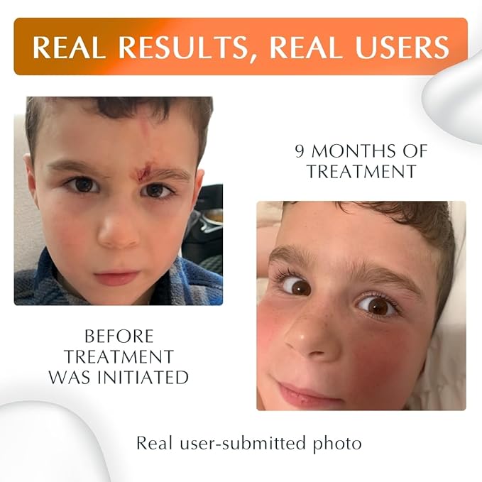 NewGel Plus by MyNewGel Day & Night Sun Defense Bundle, UV Scar Protection Gel for Day + Ultra Thick Silicone Sheeting (CLEAR) for Night, All Day Treatment