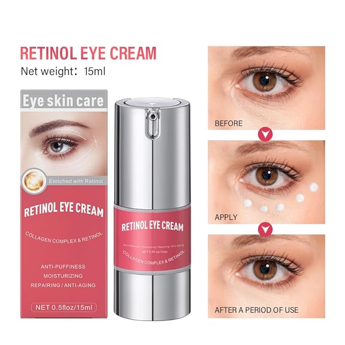 Retinol eye cream for dark