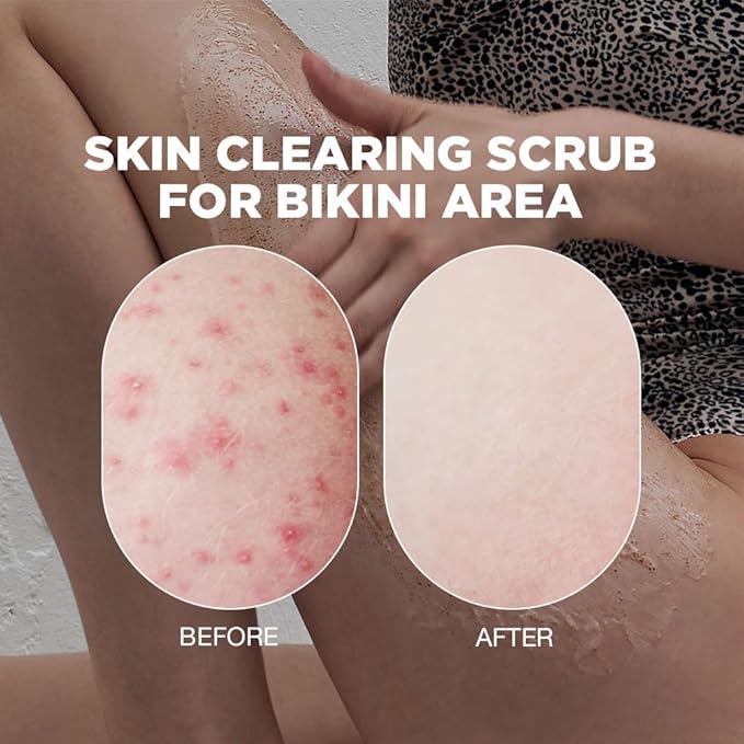 Bikini Exfoliating Scrub | Advanced Exfoliating
