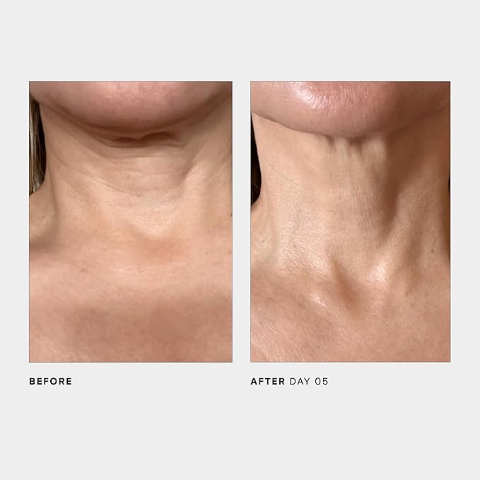 U Beauty The SCULPT Neck + Décolleté Concentrate