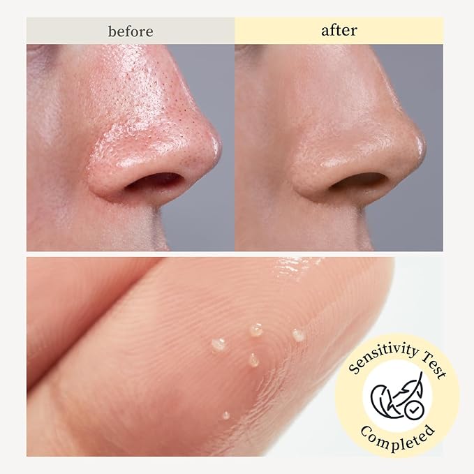 NOONI Korean Cleansing Oil - Snow Aqua 0 LHA Toning Cleansing Oil | Makeup Blackhead Remover, Pore Control, Glass Skin, Help Control Sebum, Revitalizing, Moisturizing, Gifts For Women, 6.76 Fl Oz