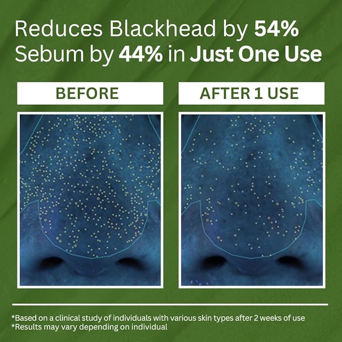 P.CALM Holy Basil Bubble Deep Mask – Holy Basil & Carbonated Water for Cleansing Pores & Blackheads, Korean Clay to Bubble Wash-Off Pack (90g / 3.17 oz)