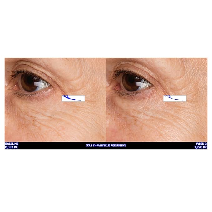 Serious Skincare - Ultra-Mare Pure Marine Infusion Revitalizing Eye Cream - Peptides - Skin Renewing - Encourages Collagen Production - Helps Reduce Wrinkle Depth - 0.5 oz