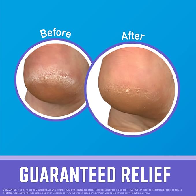 O'Keeffe's Night Treatment Combo Pack Including Working Hands Night Treatment Hand Cream, Healthy Feet Night Treatment Foot Cream and Lip Repair Night Treatment Lip Balm