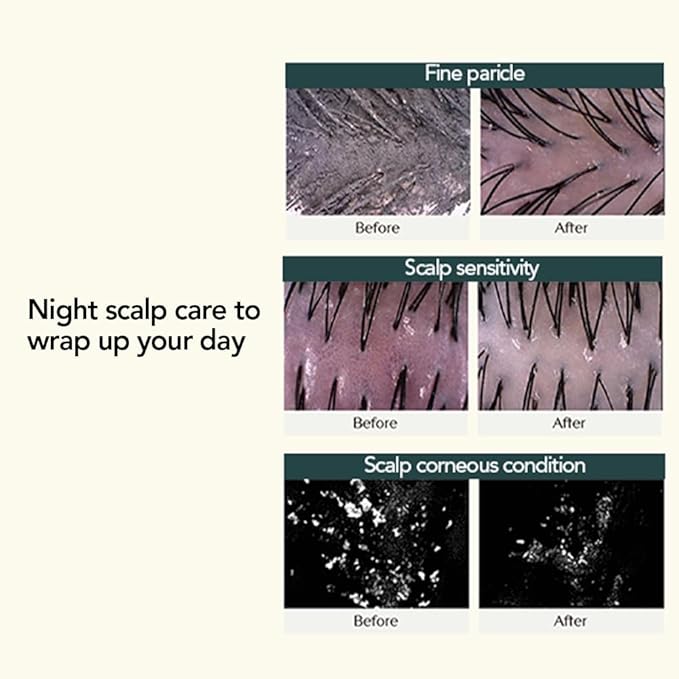 TREECELL Night Collagen Shampoo, Midnight Forest 12.2 fl oz (360 ml) | Deep Cleansing & Hydrating Night with Low-Molecular Collagen | Korean Shampoo