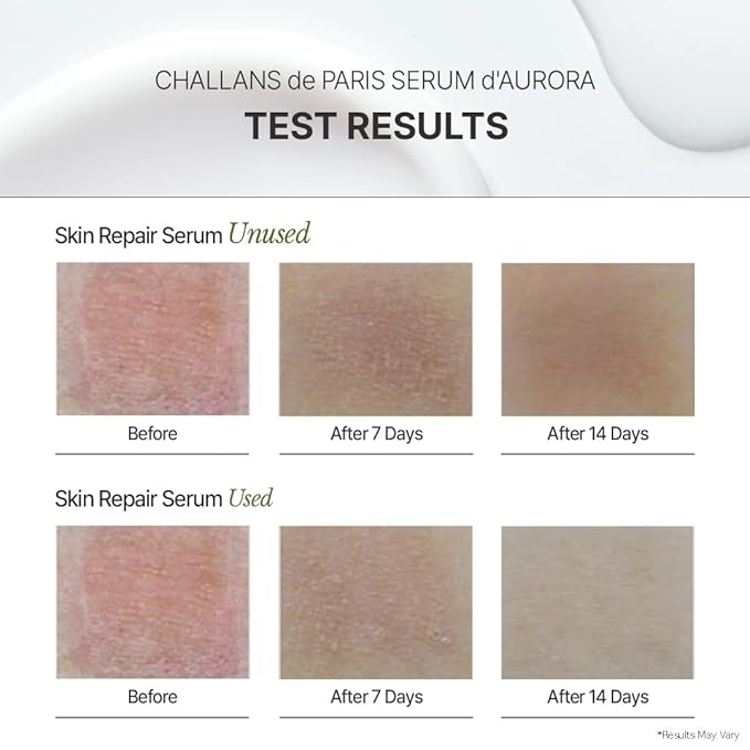 [CHALLANS de PARIS] Ampoule d’Aurora Excellence – Soothing & Balancing Skin-Barrier Support Serum with Niacinamide, Oligo-HA & Ceramide | Lightweight Watery, Hydrating Korean Skincare, 1.23 fl oz