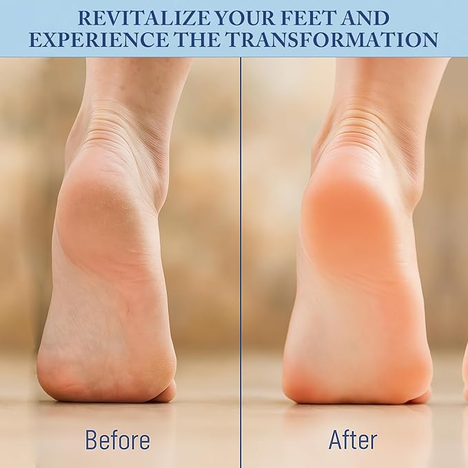 Tea Tree Oil Foot Cream Unscented with Eucalyptus Oil, Manuka Honey Natural for Feet Balm Moisturizing Instantly Hydrates & Soothes Irritated Skin & Athletes Foot Repair & Callus Remover 7 Oz