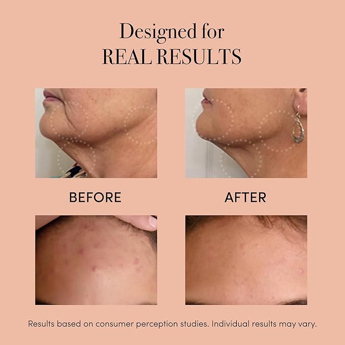 reVive Light Therapy Lux Collection Clinical Device for Aging and Acne, Red, Infrared & Blue Light Therapy Products for Wrinkles, Fine Lines, and Breakouts, Triangular Head, At-Home Acne Tools