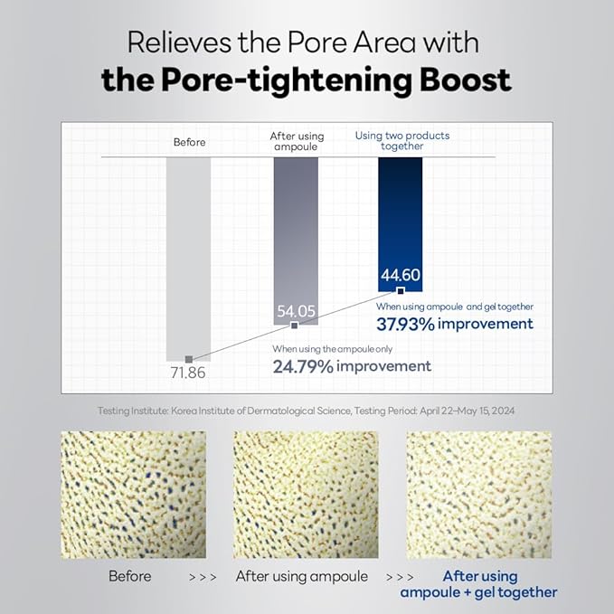 Mediheal Collagen Spicule 3000ppm Intensive Serum – Micro Needle Serum for Pore Care, Soothing & Skin Texture Improvement, 2-Step Pore Care Set,Collagen Spicule Ampoule and Gel Mask Set,4 pcs
