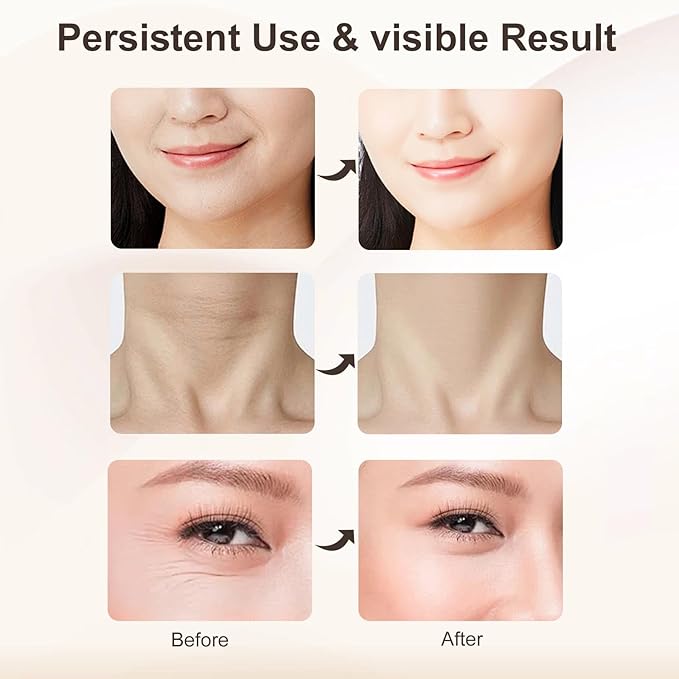 Facial and Neck Massager,7 Color LED Light Therapy for Face,Face Lift Device,Beauty Face Massager Tools for Skin Care (White)