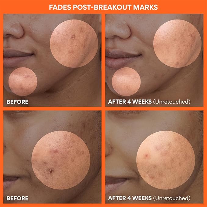 innisfree Green Tea Enzyme Vitamin C Toner Pads, Korean Brightening Face Pads for Dark Spots, Radiance, and Even Skin Tone