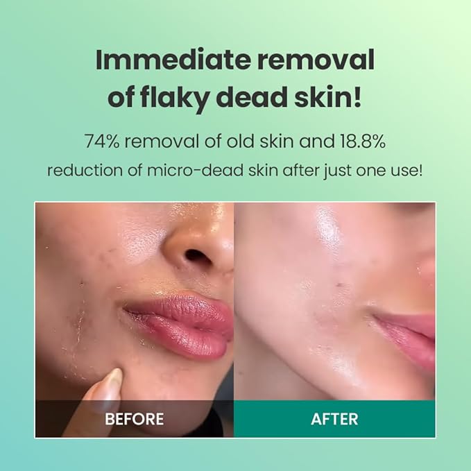 Dr.G Brightening Peeling Gel (120ml)