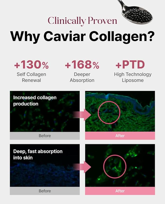 Delere Caviar Glow Dewy Cream | Hydrating Caviar Collagen Cream | Korean Hyaluronic Acid Moisturizer for Radiant Glass Skin, 1.7oz