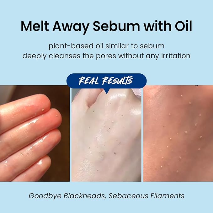 coxir ULTRA HYALURONIC CLEANSING OIL | Korean Facial Cleansing Oil for Blackheads, Makeup & Sebum | Multi-Layer Hyaluronic Acid, Vegan & Non-Comedogenic Cleanser | 5.07 fl.oz